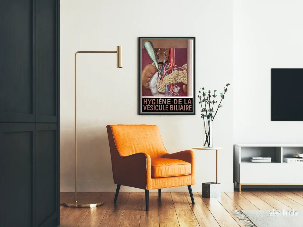 Vintage affisch för gallblåsehygien - medicinsk väggdekoration - Bild 2