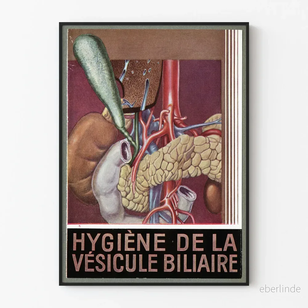 Vintage affisch för gallblåsehygien - medicinsk väggdekoration