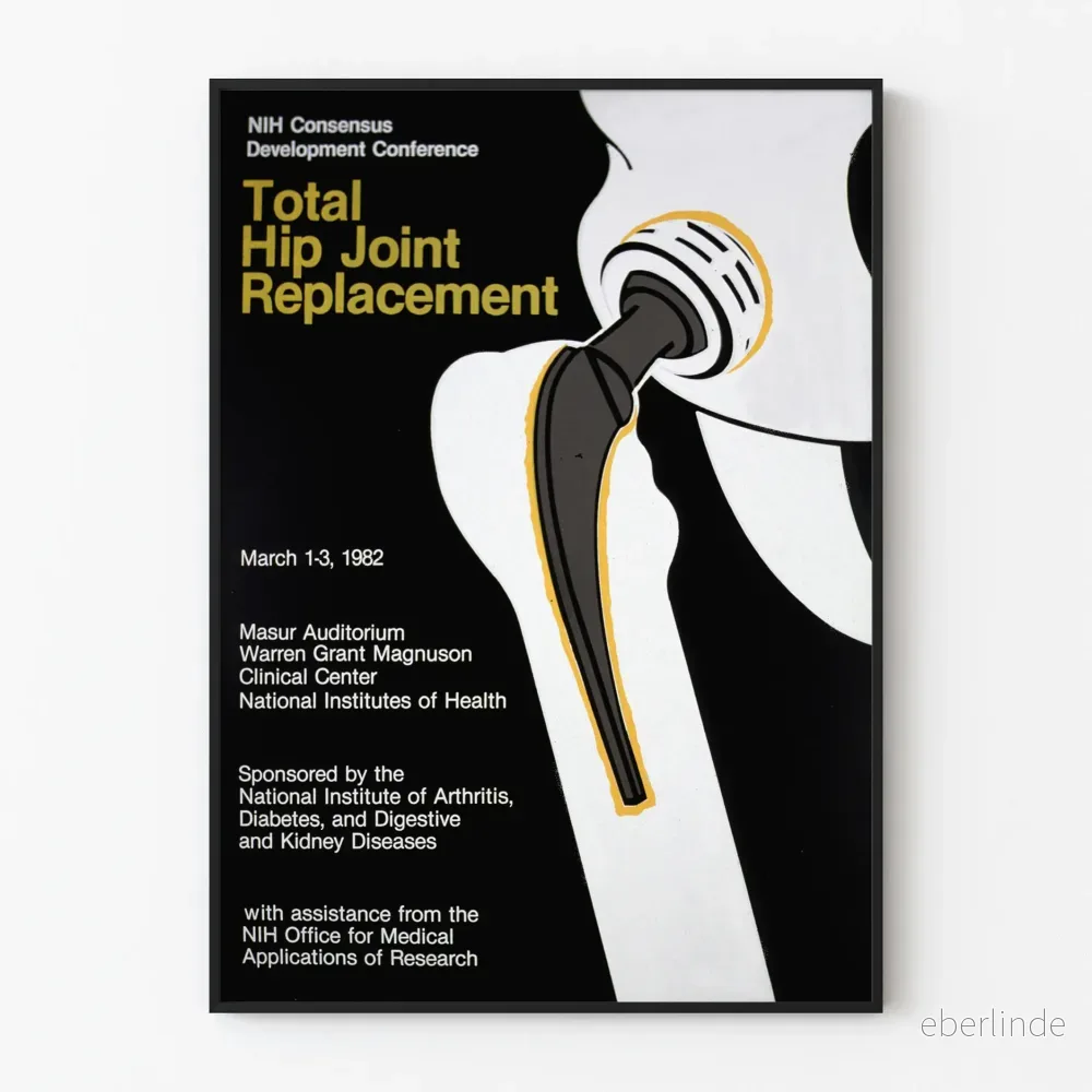 medicinsk väggposter för total höftledsbyte vintage