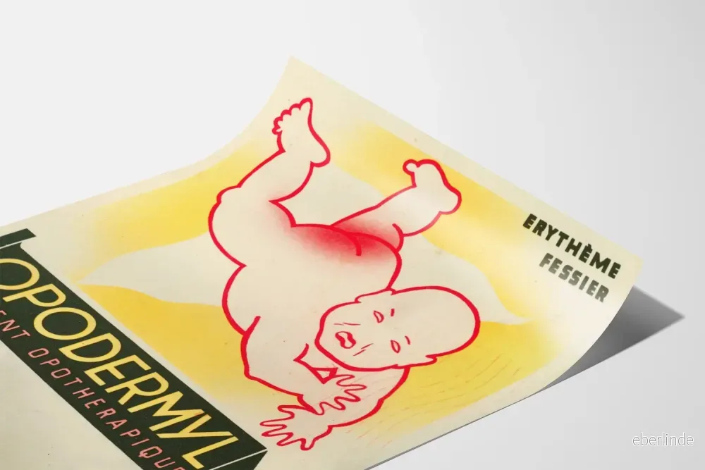 Vintageposter Opodermyl mot blöjdermatit - Bild 3